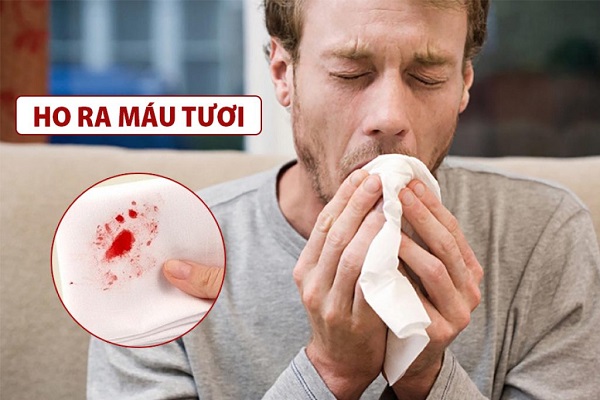 Mơ thấy ho ra máu, ói ra máu báo điềm gì? Đánh con gì